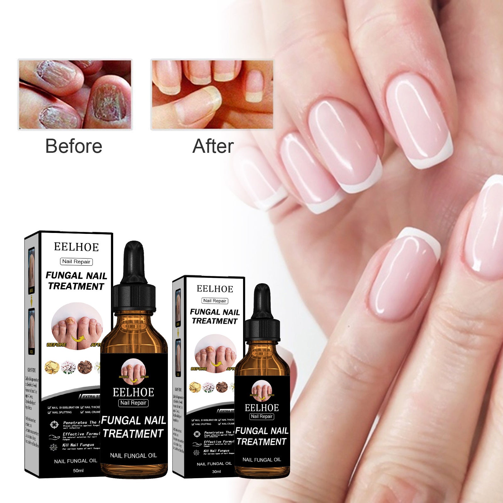 EELHOE Nail Repair Liquid Thickening | Yazijico™