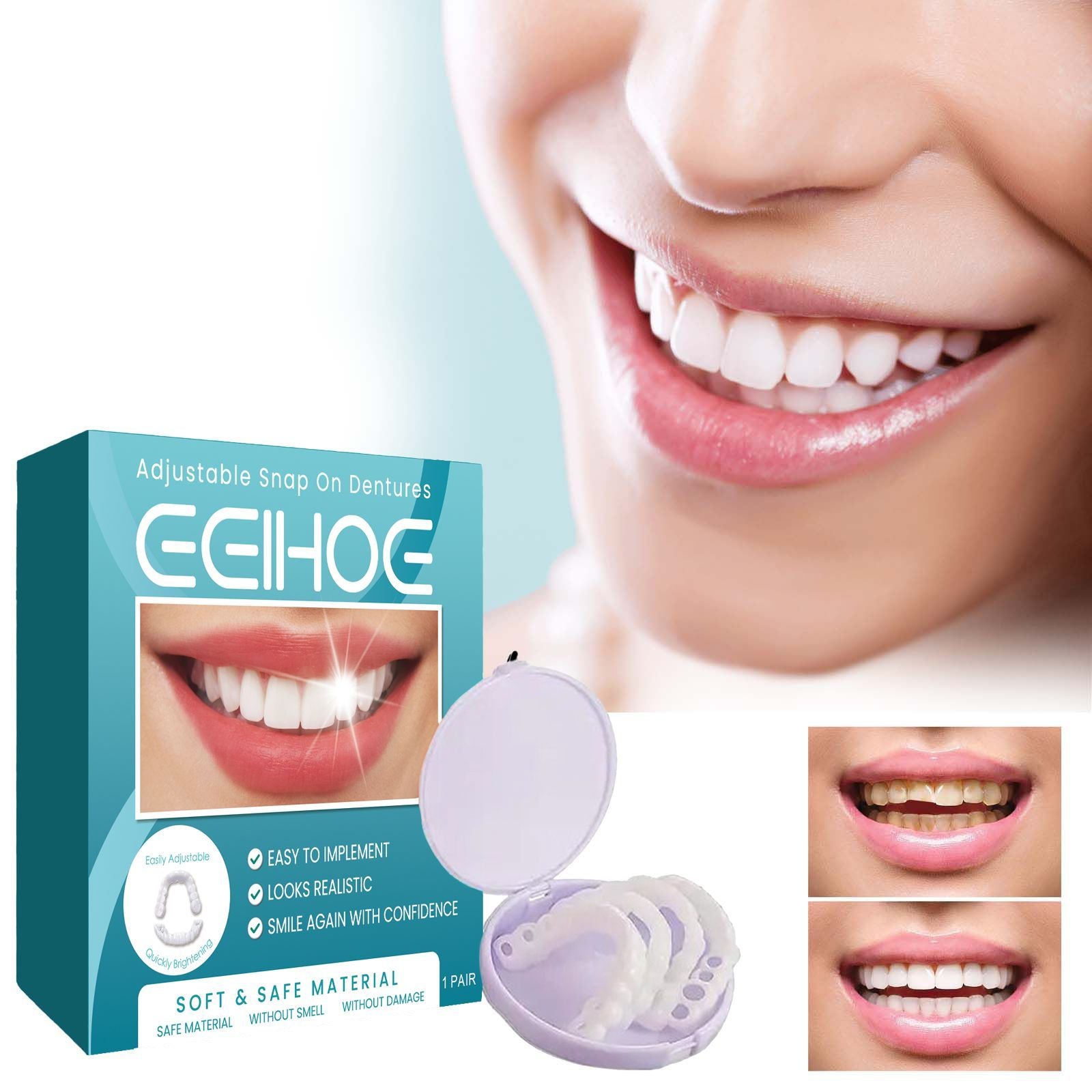 Adjustable Snap On Dentures Temporary Gap Filling   | Yazijico™ 