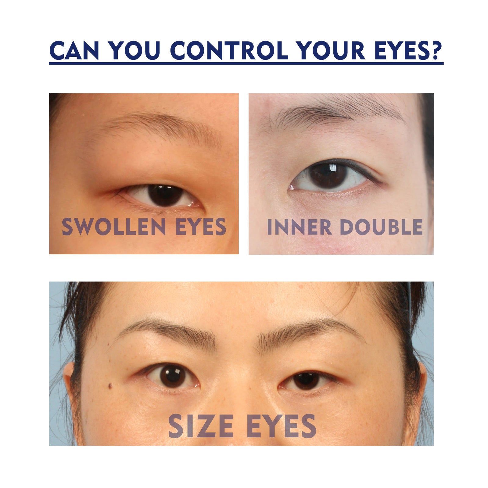Double Eyelid Fixing Cream EELHOE  | Yazijico™