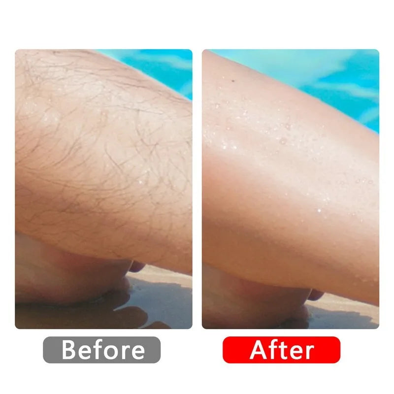 Upgraded new crystal Hair Remover | Yazijico™